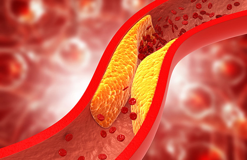 Tin tức công ty mới nhất về Phân giải cholesterol: Con đường dẫn đến một cơ thể khỏe mạnh
