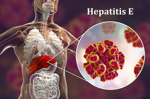 Latest company news about Mối đe dọa của virus đối với việc sinh sản: Mối nguy hiểm vô hình của viêm gan E