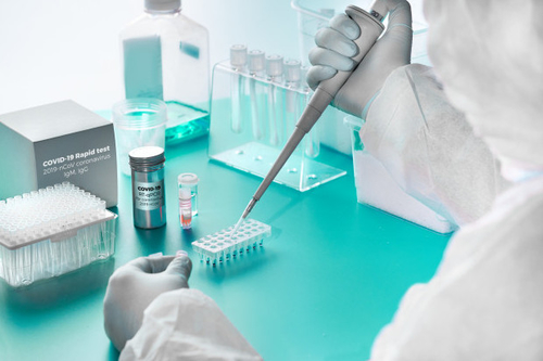 Tin tức công ty mới nhất về Ảnh hưởng của các globulin miễn dịch (IgA, IgG, IgM)
